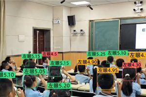 科技赋能公益:启明同学AI系统引领校园近视防控新范式